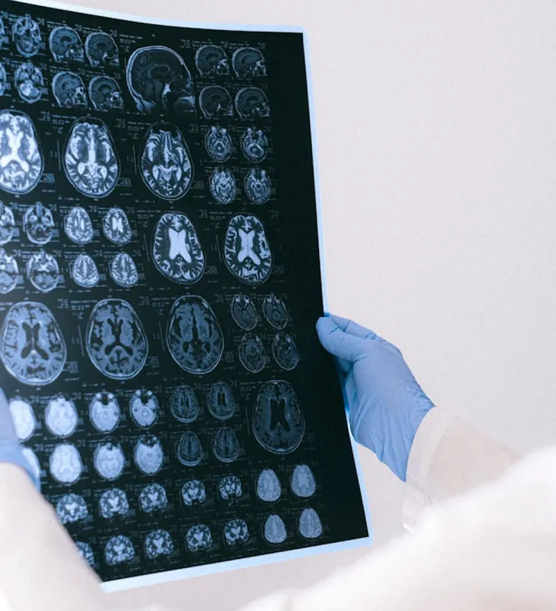 Étude clinique avec protocole combiné produit et routine cognitive